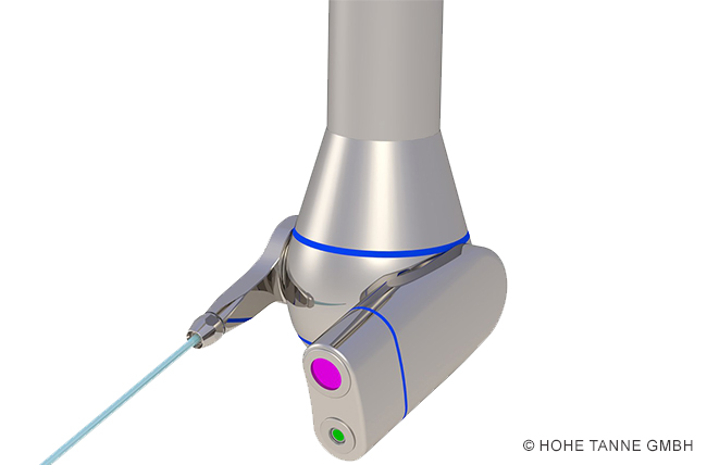 Adaptive Jet Cleaner AJCsens